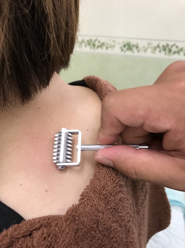 「ローラー鍼」も痛くないハリです。ハリが苦手な方に使用します